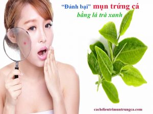 Trị mụn trứng cá bằng trà xanh