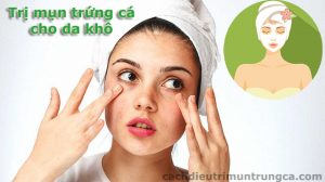 Cách trị mụn trứng cá cho da khô