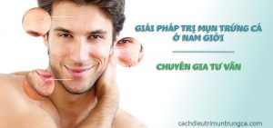 Cách trị mụn trứng cá cho nam giới