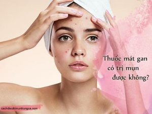 thuốc mát gan có trị mụn không