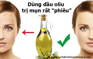 Dùng dầu oliu trị mụn