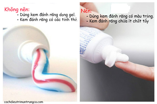 Hướng dẫn lựa chọn kem đánh răng trị mụn đúng cách