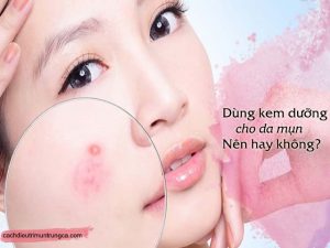 Đang bị mụn có nên dùng kem dưỡng da ban đêm không?