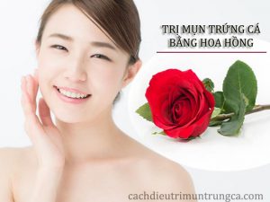 Trị mụn trứng cá bằng nước hoa hồng