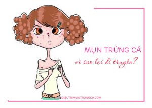 mụn có yếu tố di truyền