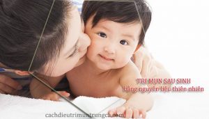 Trị mụn sau sinh hiệu quả chỉ bằng nguyên liệu tự nhiên