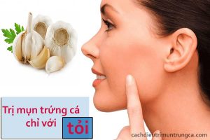 Cách trị mụn trứng cá bằng tỏi