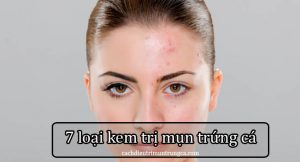 Kem trị mụn trứng cá hiệu quả