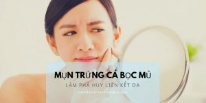 Mụn trứng cá bọc mủ