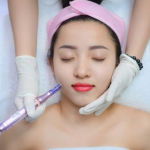 Công nghệ xoá sẹo Phi kim tế bào gốc đa tầng độc quyền tại Favina Clinics & Beauty Spa có gì đặc biệt?